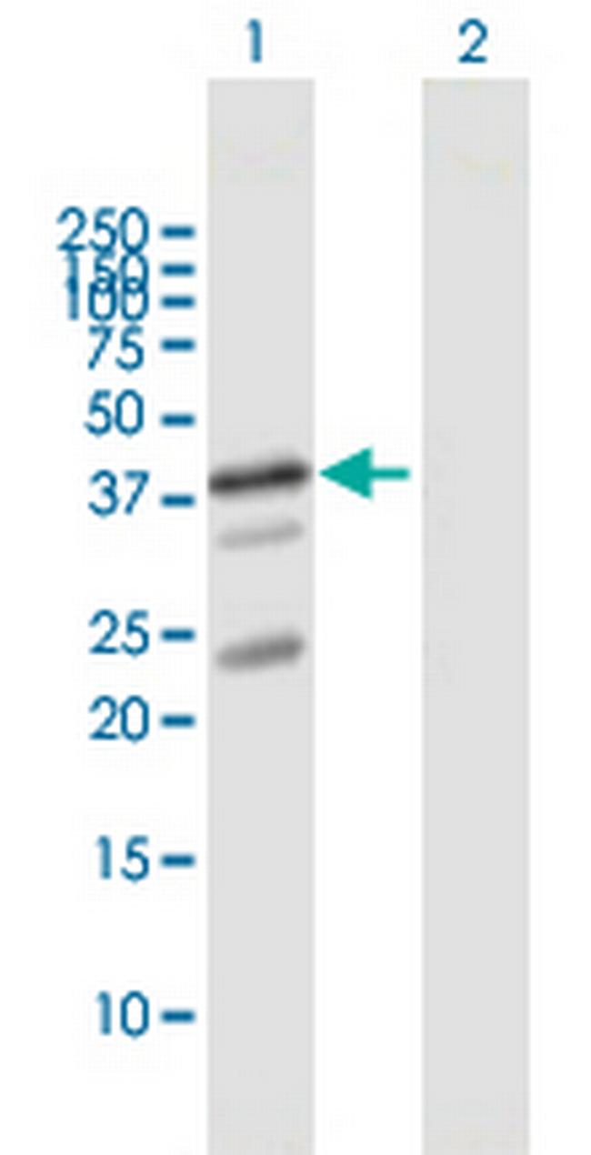 UBL7 Antibody in Western Blot (WB)