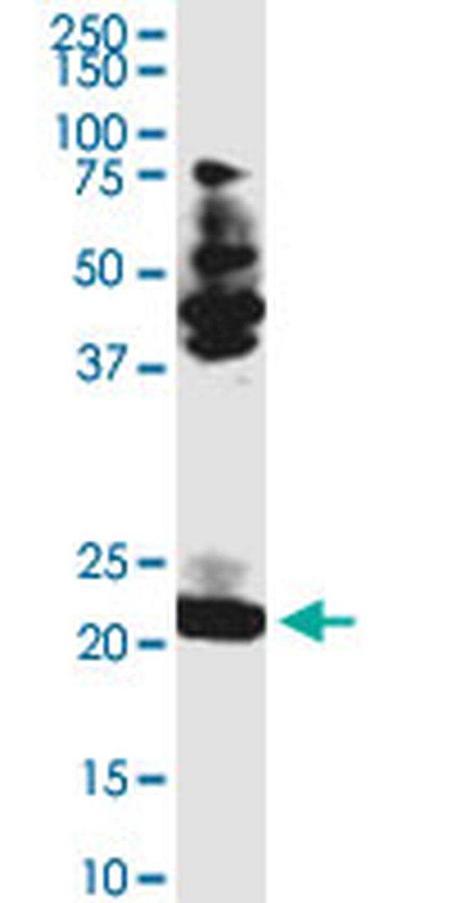 TCEAL3 Antibody in Western Blot (WB)