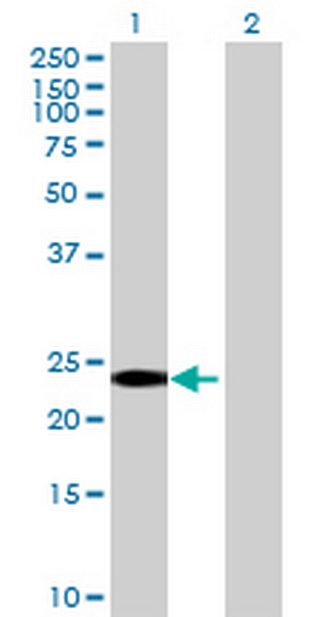 RGS8 Antibody in Western Blot (WB)