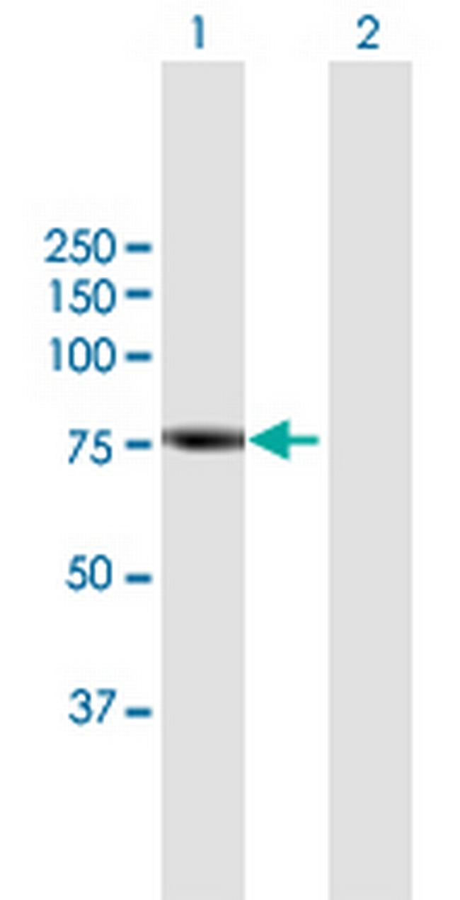 RHPN2 Antibody in Western Blot (WB)