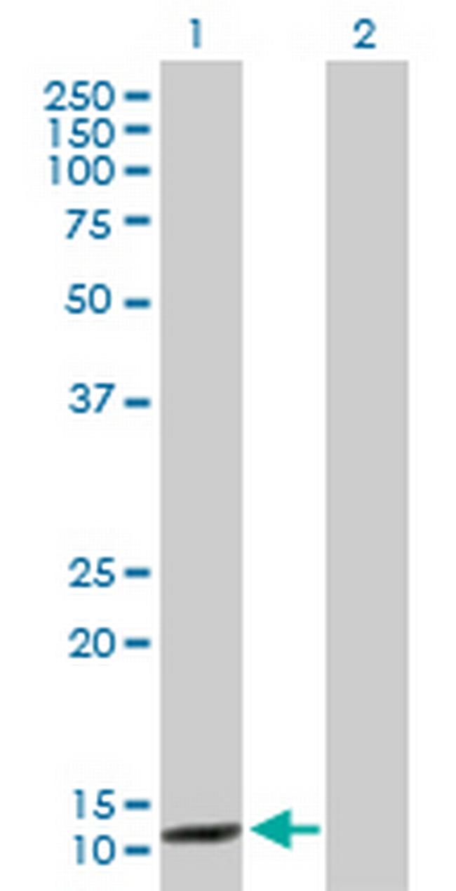 CCNB3 Antibody in Western Blot (WB)
