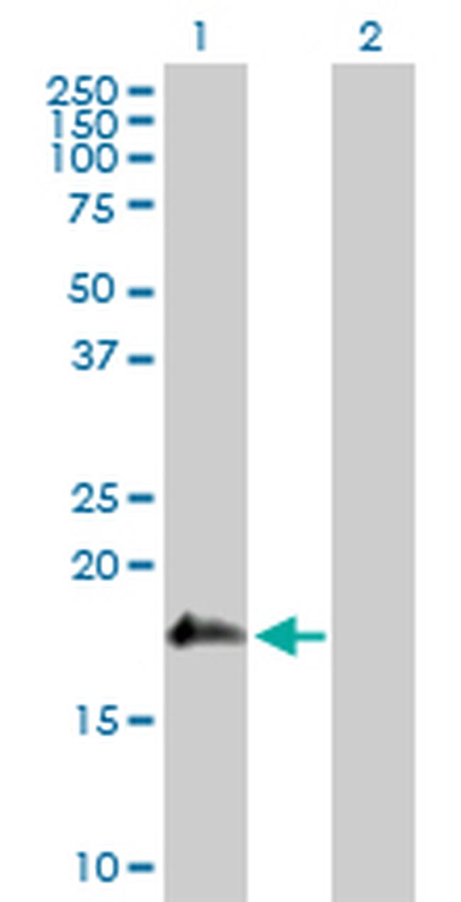 SSH2 Antibody in Western Blot (WB)