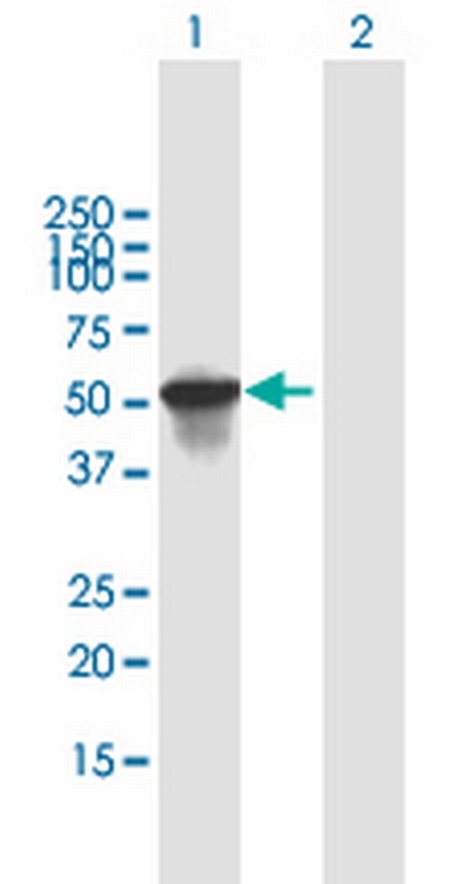 SCIN Antibody in Western Blot (WB)