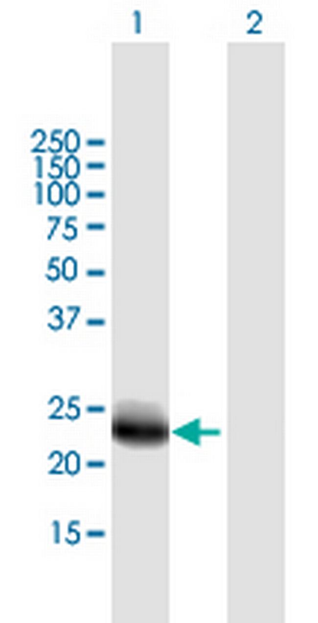 DNAJC5B Antibody in Western Blot (WB)