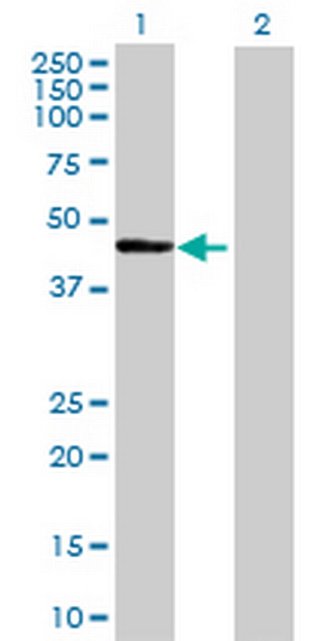 HSFY1 Antibody in Western Blot (WB)