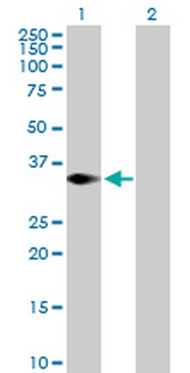 TRIM4 Antibody in Western Blot (WB)