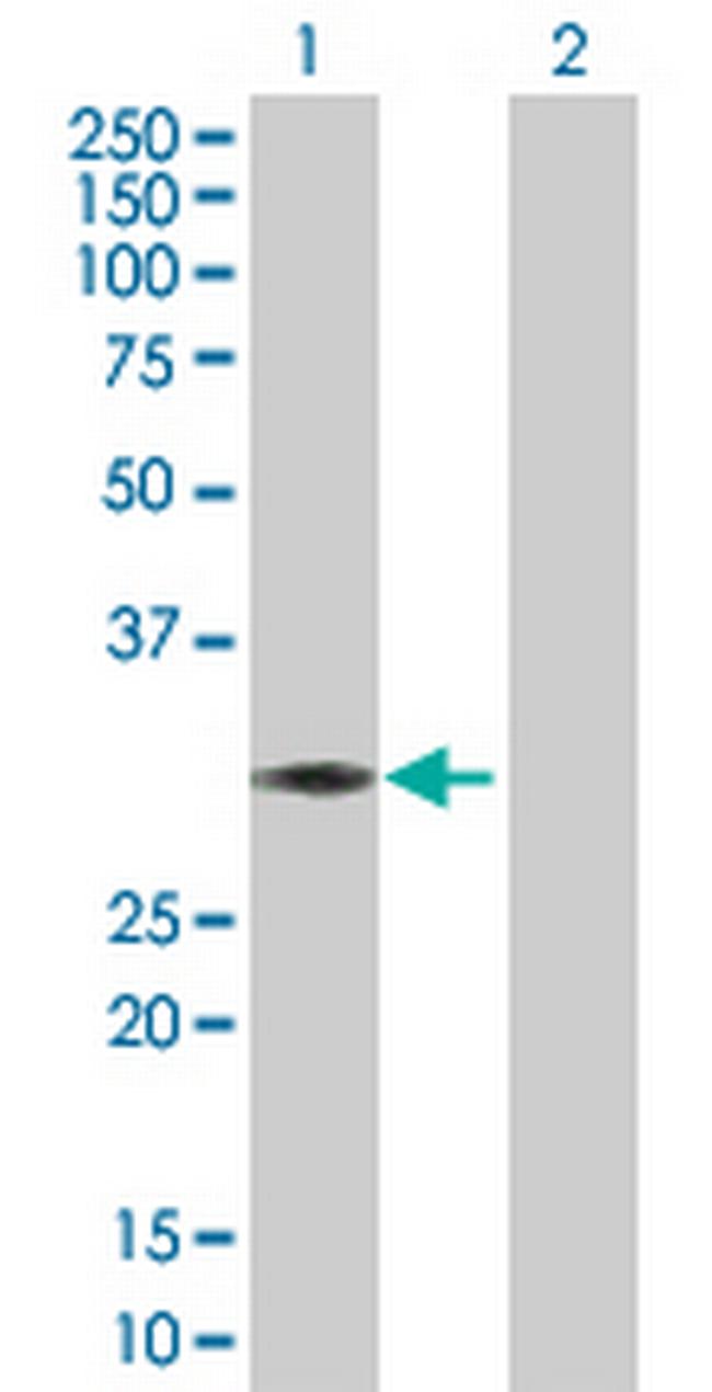 ABCC10 Antibody in Western Blot (WB)