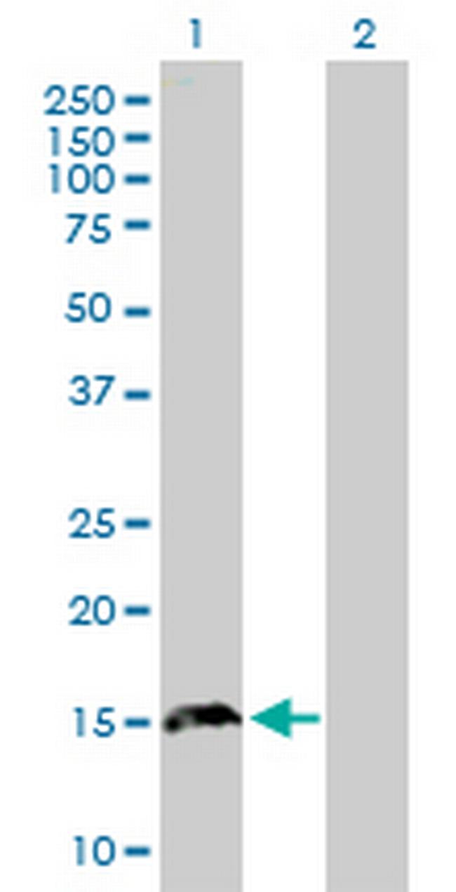 TPD52L3 Antibody in Western Blot (WB)