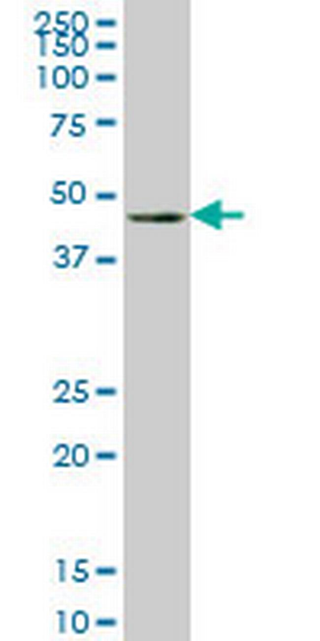 LHX4 Antibody in Western Blot (WB)