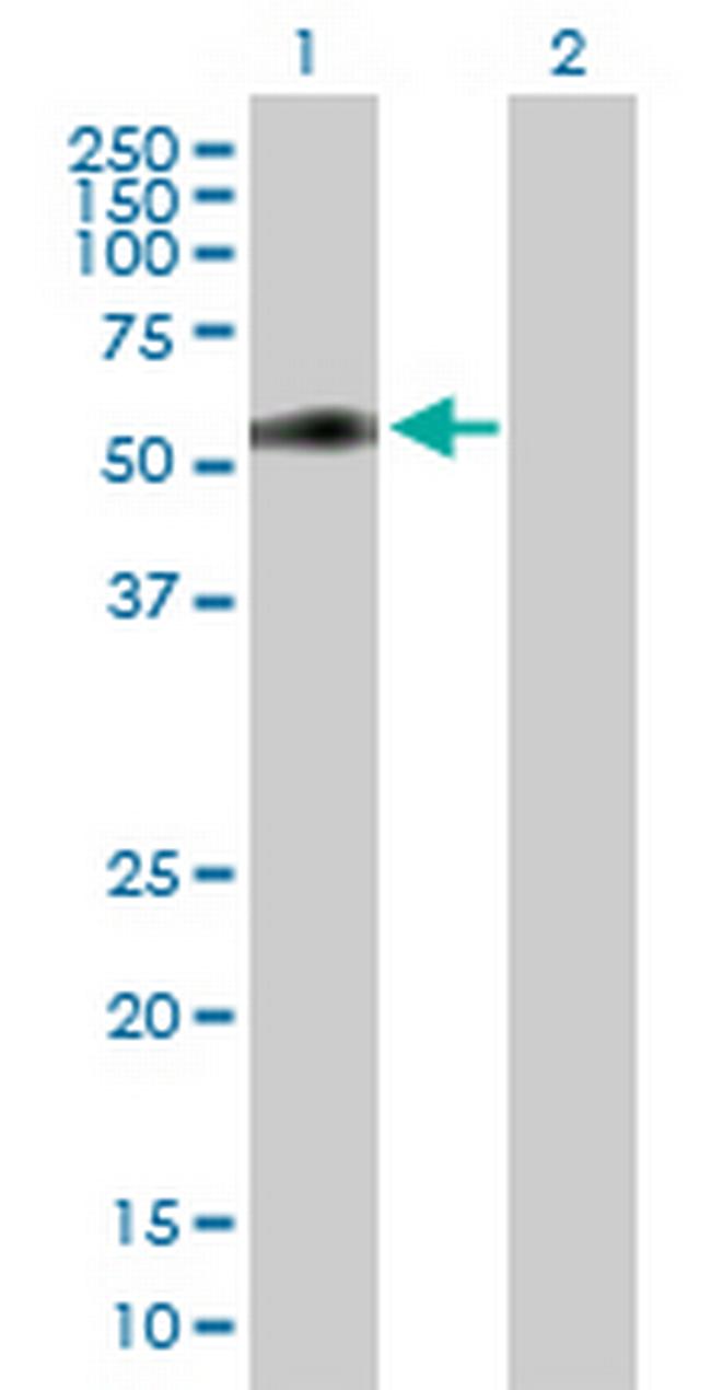MIDN Antibody in Western Blot (WB)