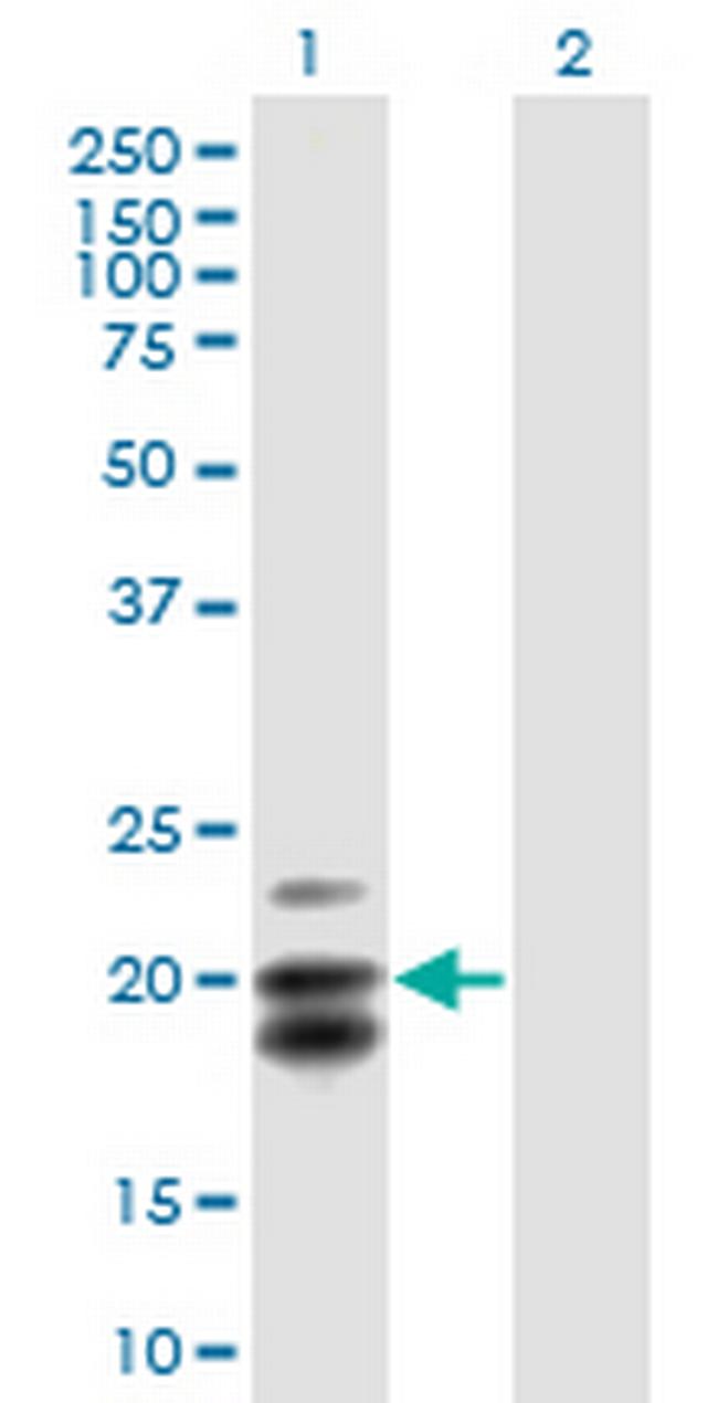 CEACAM21 Antibody in Western Blot (WB)