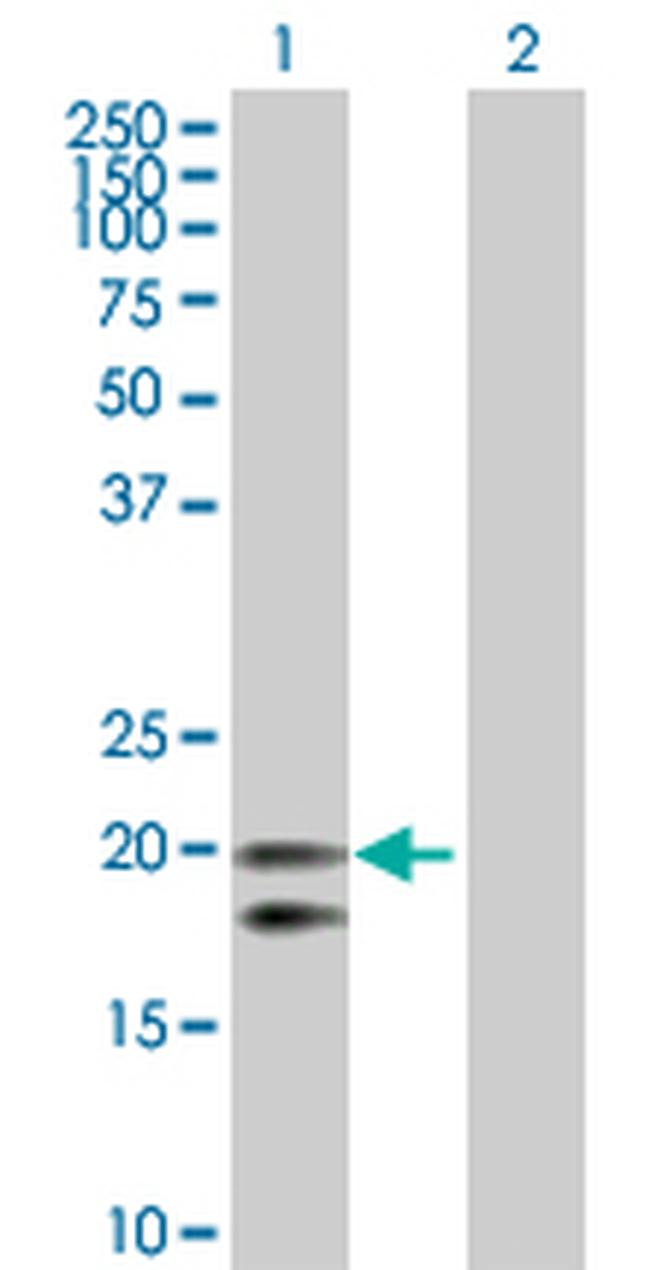 CEACAM21 Antibody in Western Blot (WB)