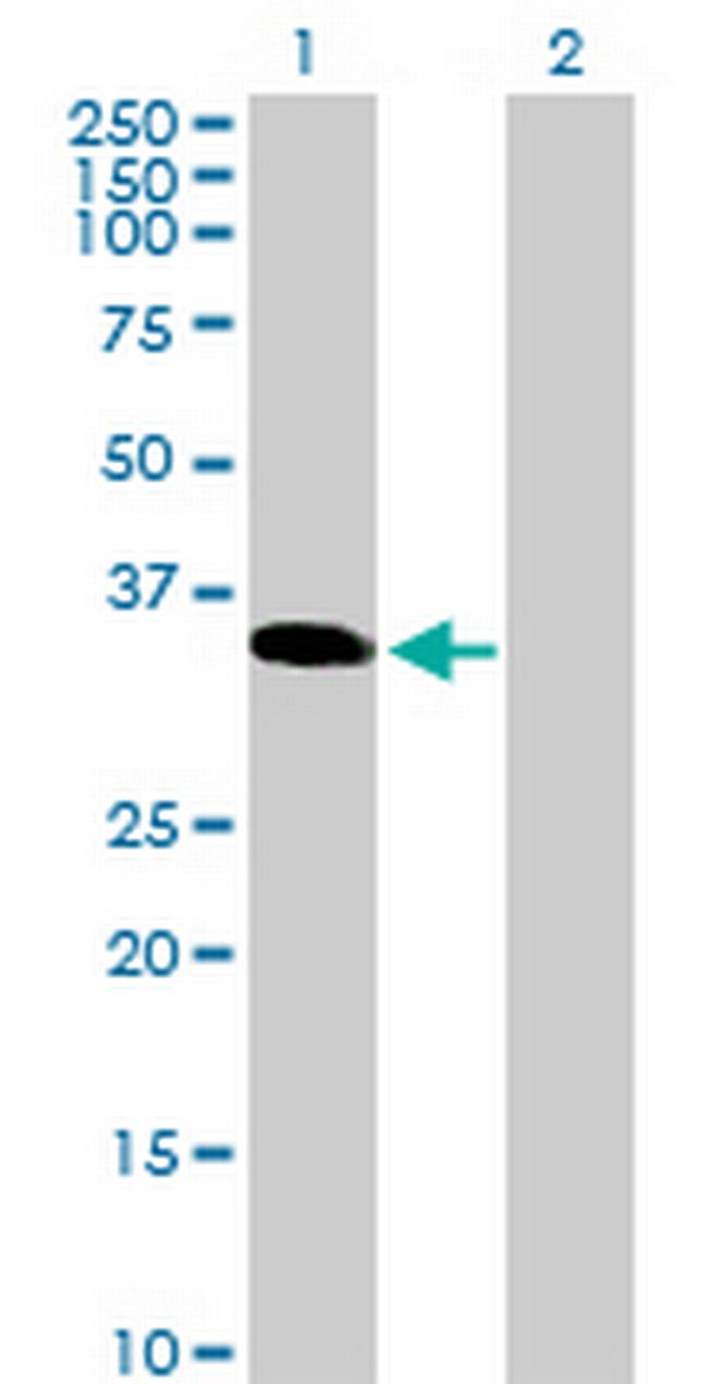 TGIF2LX Antibody in Western Blot (WB)