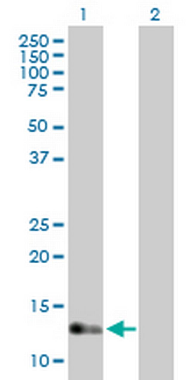 IFT20 Antibody in Western Blot (WB)