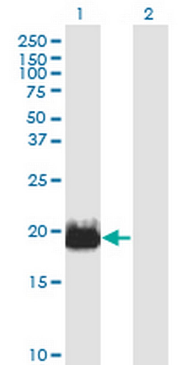 IFT20 Antibody in Western Blot (WB)