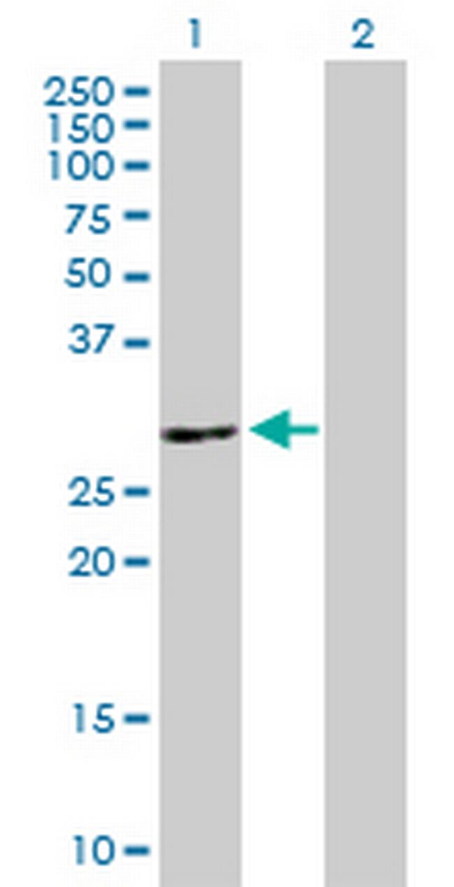 ATP6V1E2 Antibody in Western Blot (WB)
