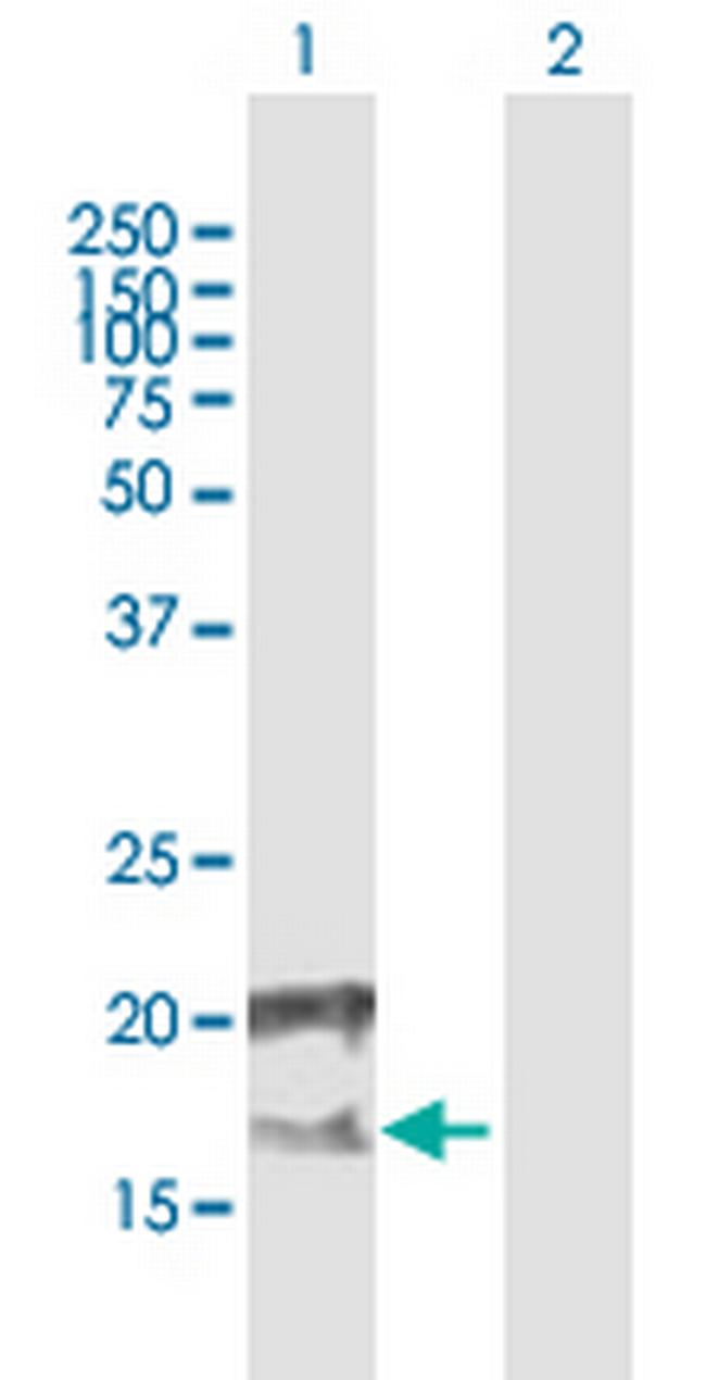 CCDC126 Antibody in Western Blot (WB)