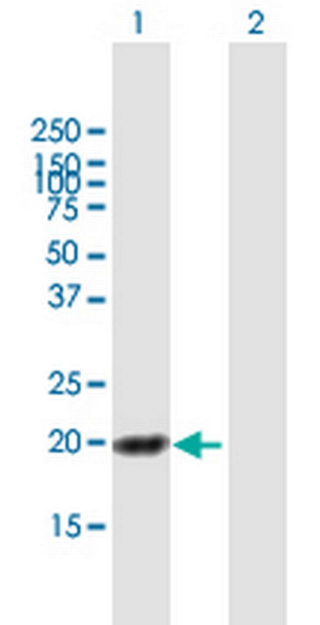 HN1L Antibody in Western Blot (WB)