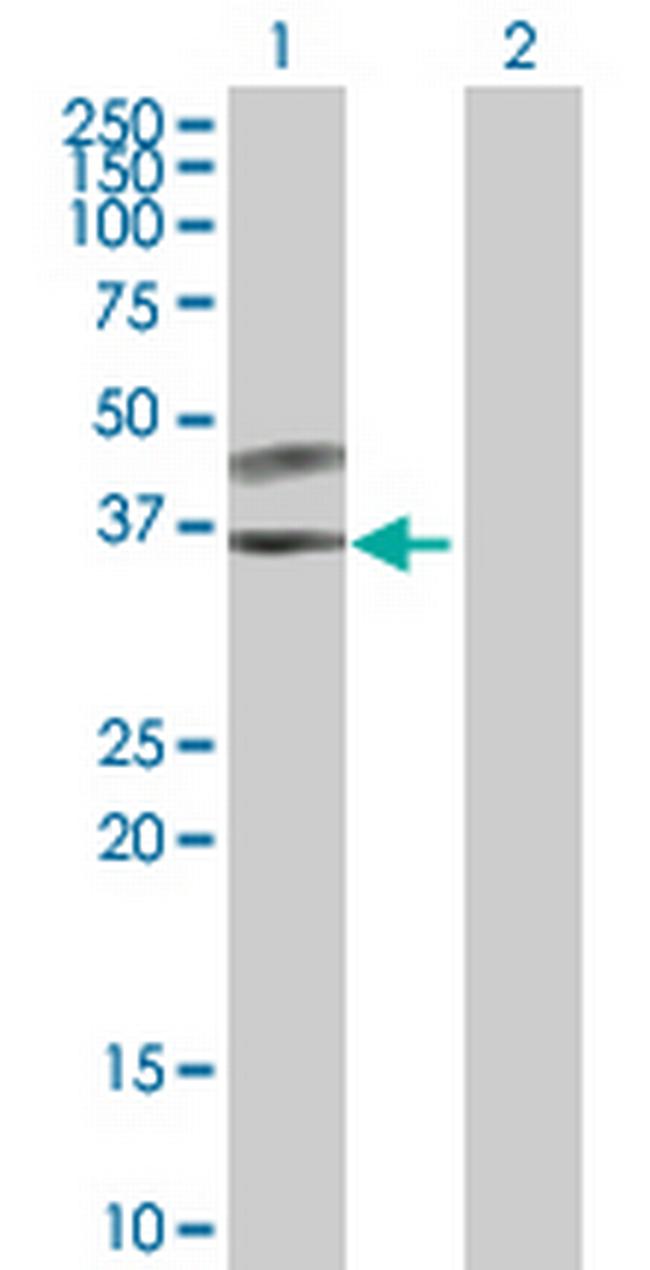 SPSB3 Antibody in Western Blot (WB)