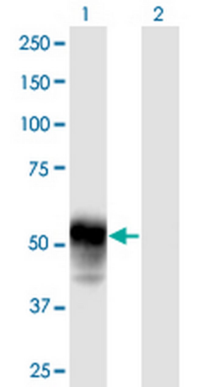 ESAM Antibody in Western Blot (WB)