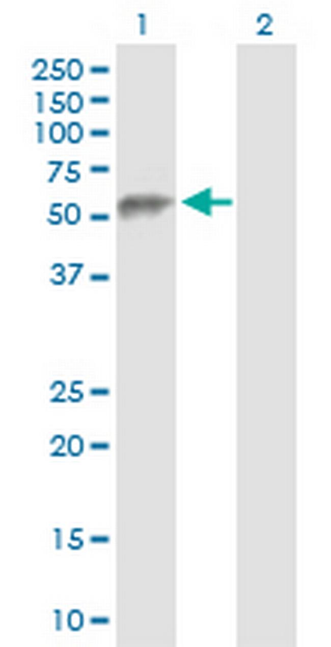 ESAM Antibody in Western Blot (WB)