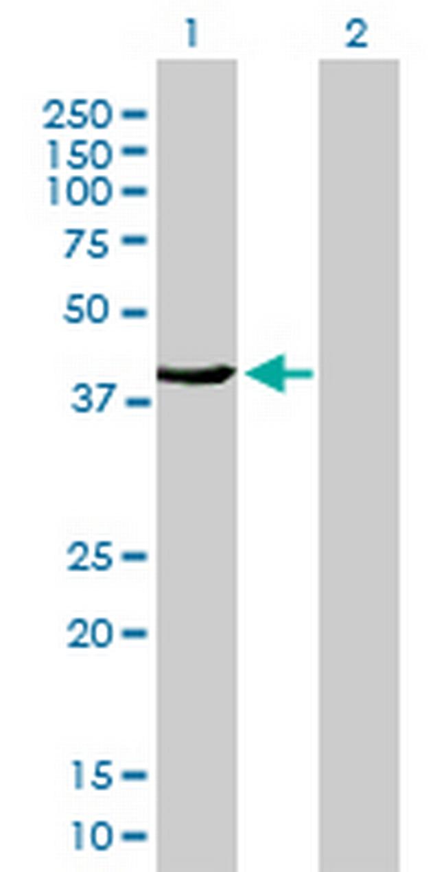 FMNL3 Antibody in Western Blot (WB)