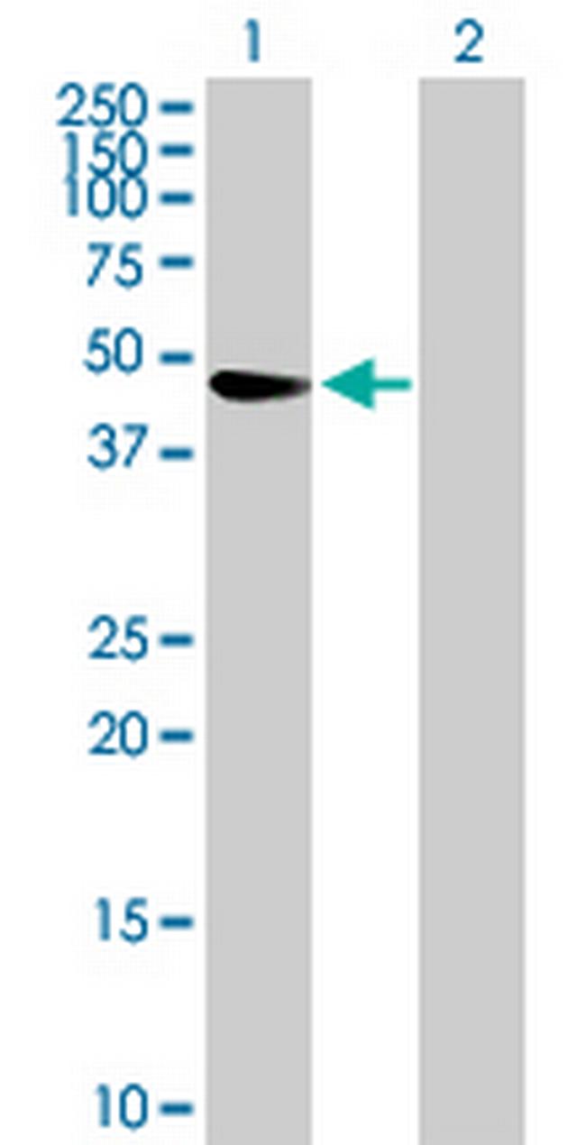 TRIM47 Antibody in Western Blot (WB)