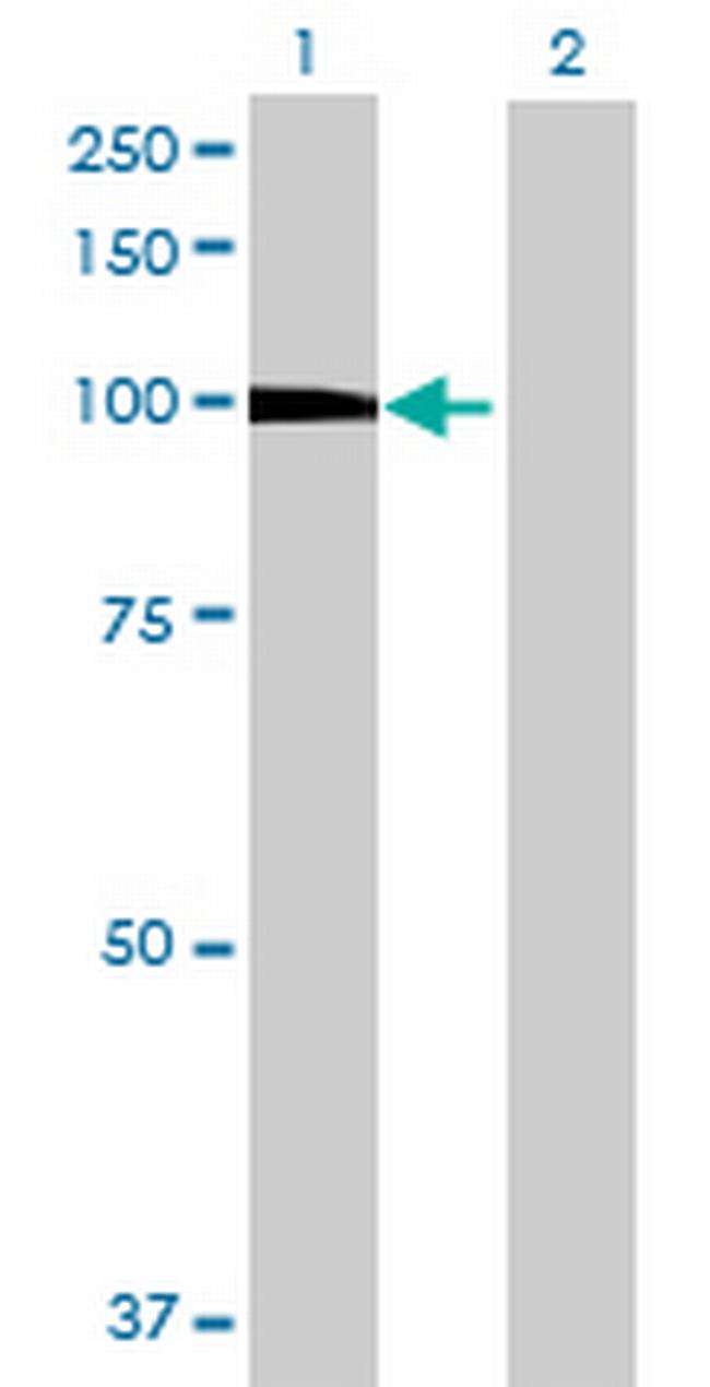 DKFZp434B1231 Antibody in Western Blot (WB)
