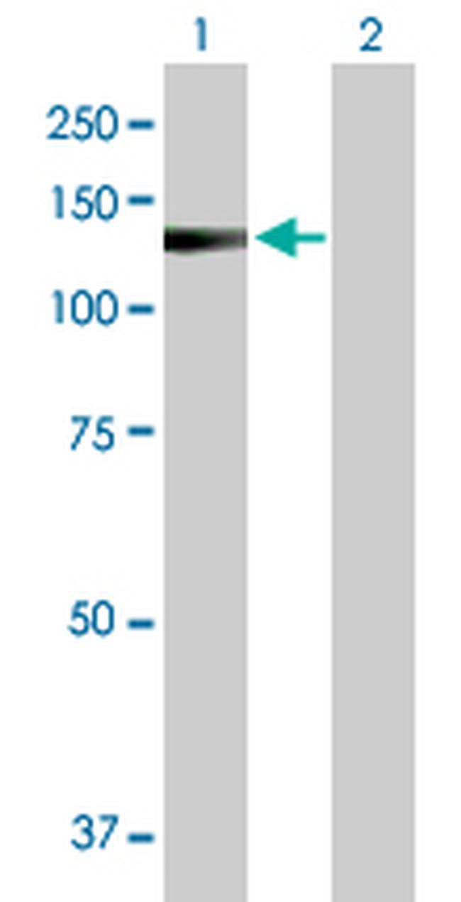 DKFZP434B1231 Antibody in Western Blot (WB)