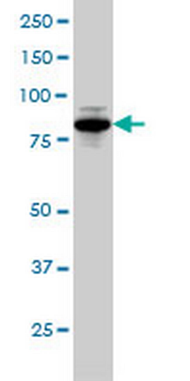 DKFZp434B1231 Antibody in Western Blot (WB)