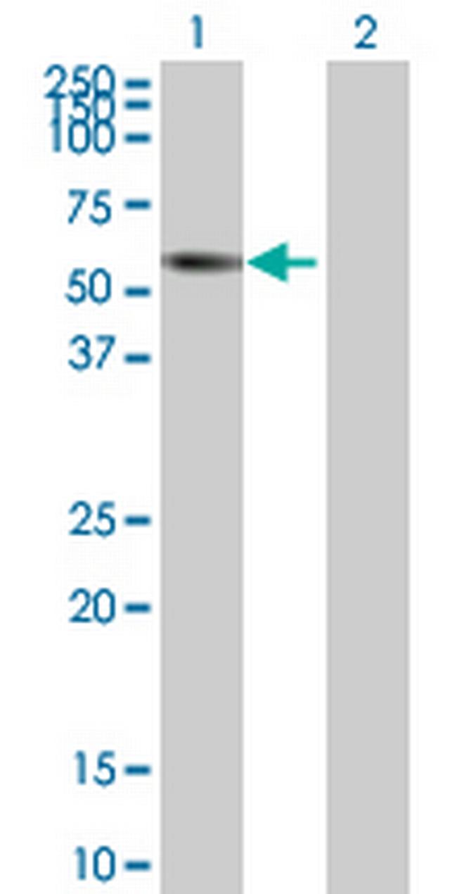 ZNF502 Antibody in Western Blot (WB)