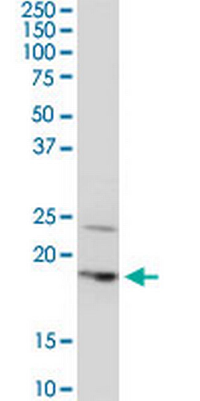 BTF3L4 Antibody in Western Blot (WB)