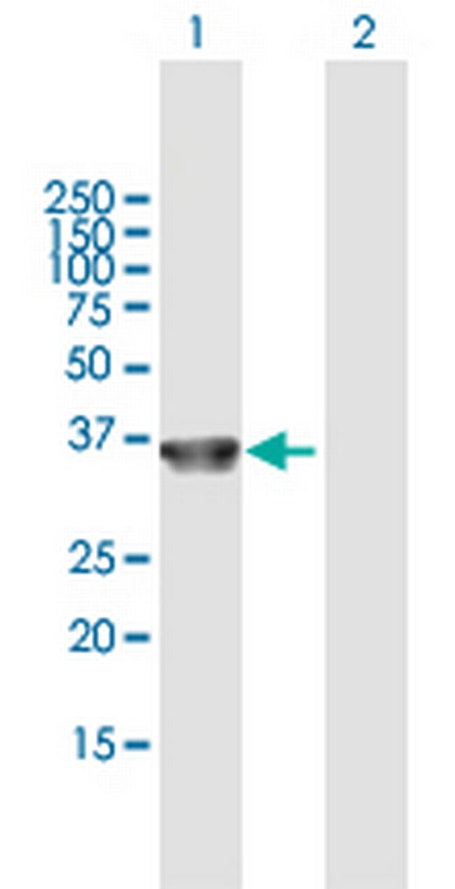 COL23A1 Antibody in Western Blot (WB)