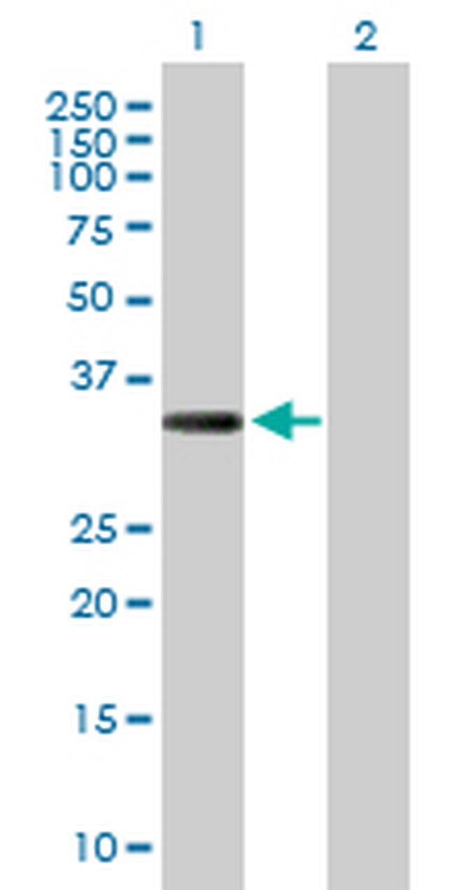 COL23A1 Antibody in Western Blot (WB)