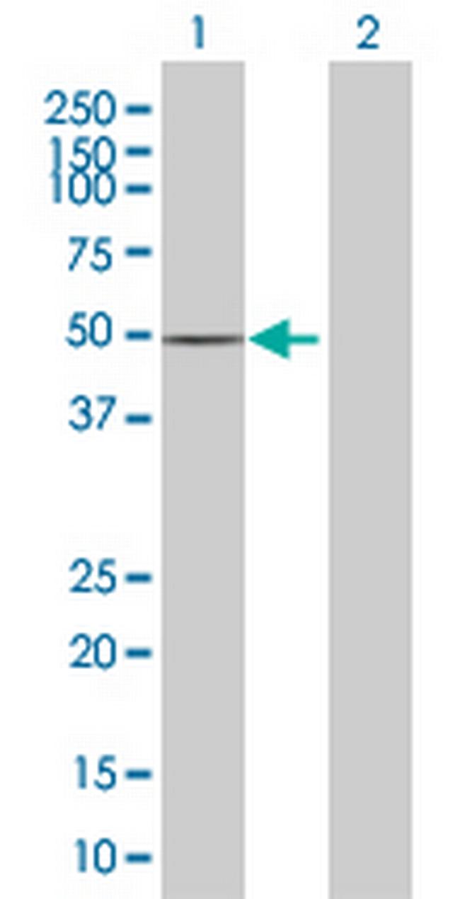 CCDC16 Antibody in Western Blot (WB)