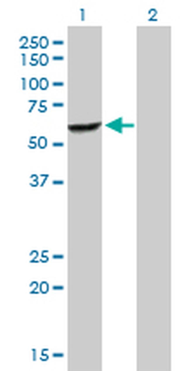 DEPDC7 Antibody in Western Blot (WB)