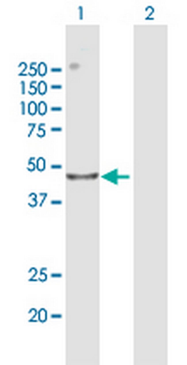 CENPL Antibody in Western Blot (WB)