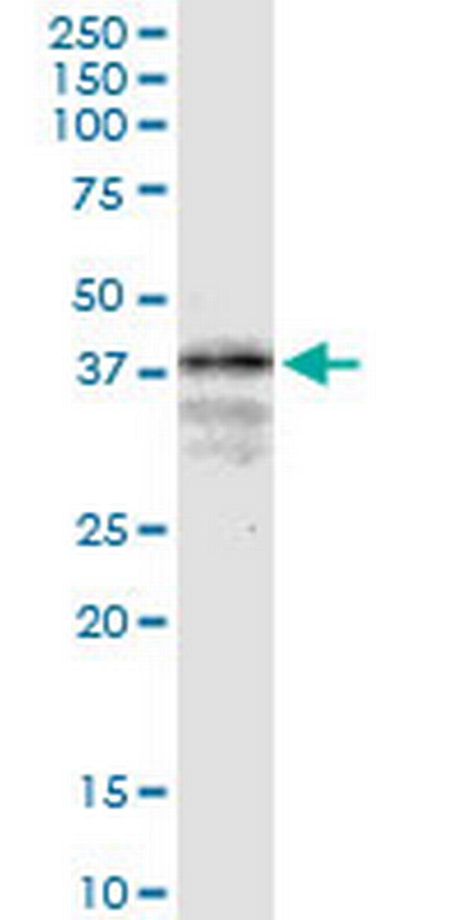 LONRF1 Antibody in Western Blot (WB)