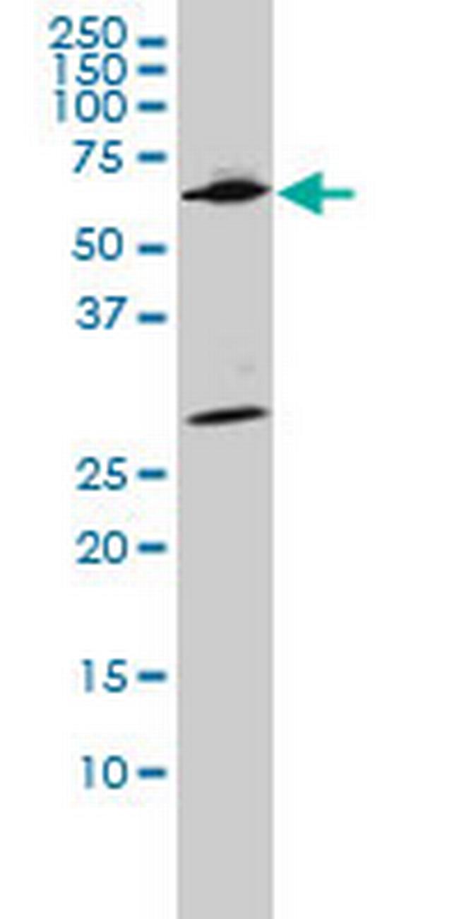 WDR20 Antibody in Western Blot (WB)