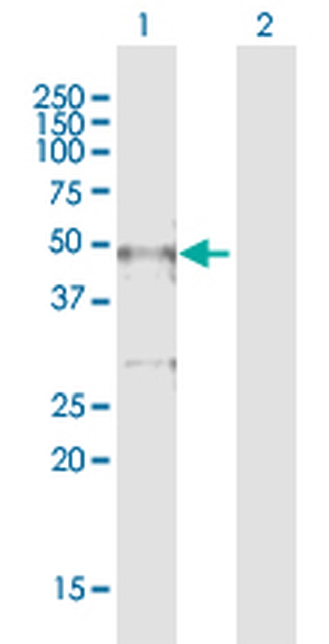 TTC5 Antibody in Western Blot (WB)