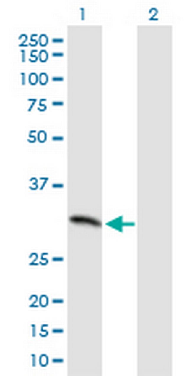 MCART1 Antibody in Western Blot (WB)