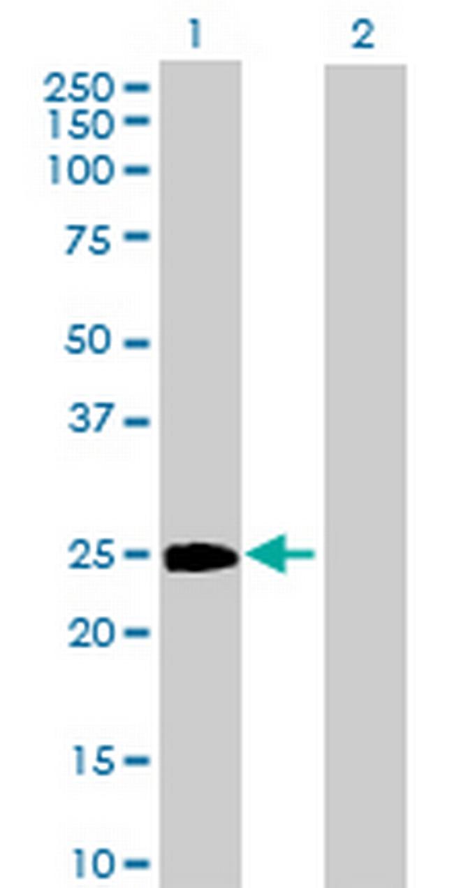 GGTLA4 Antibody in Western Blot (WB)