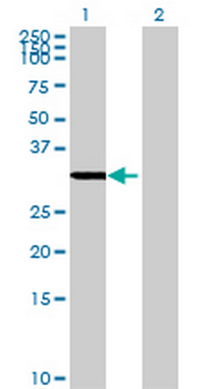 GLYATL1 Antibody in Western Blot (WB)