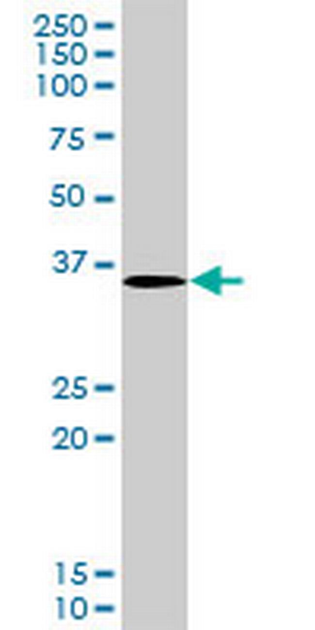 LYK5 Antibody in Western Blot (WB)