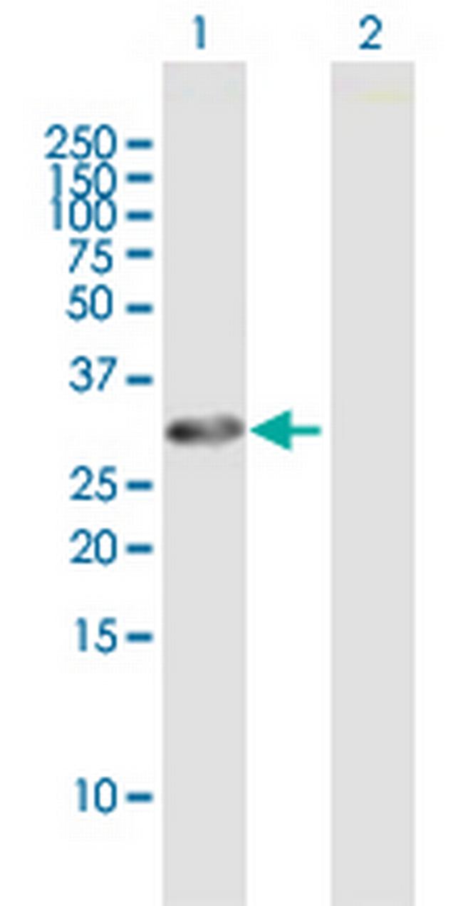 SCYL1BP1 Antibody in Western Blot (WB)