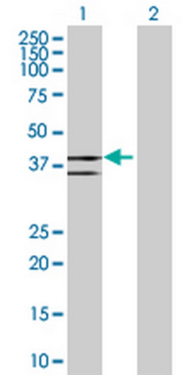 LDHAL6B Antibody in Western Blot (WB)