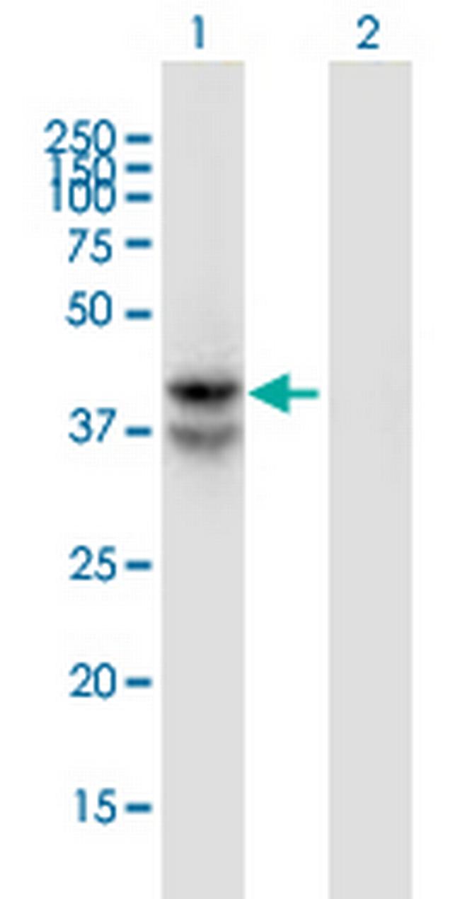 LDHAL6B Antibody in Western Blot (WB)