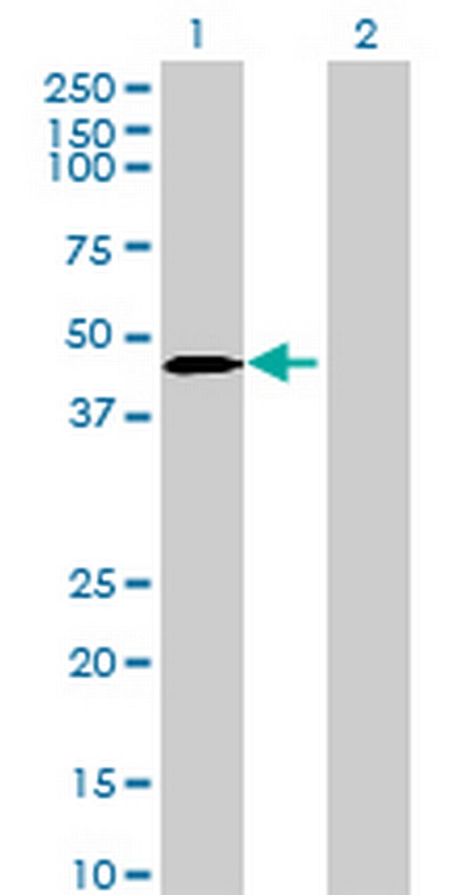 MGC13138 Antibody in Western Blot (WB)