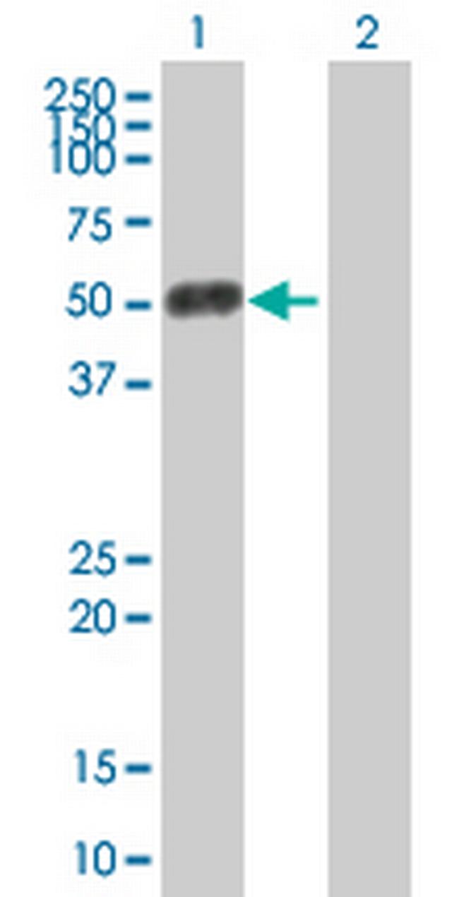 OTOP2 Antibody in Western Blot (WB)
