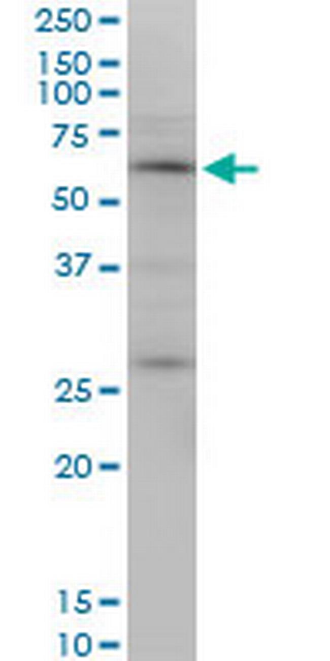 OTOP2 Antibody in Western Blot (WB)